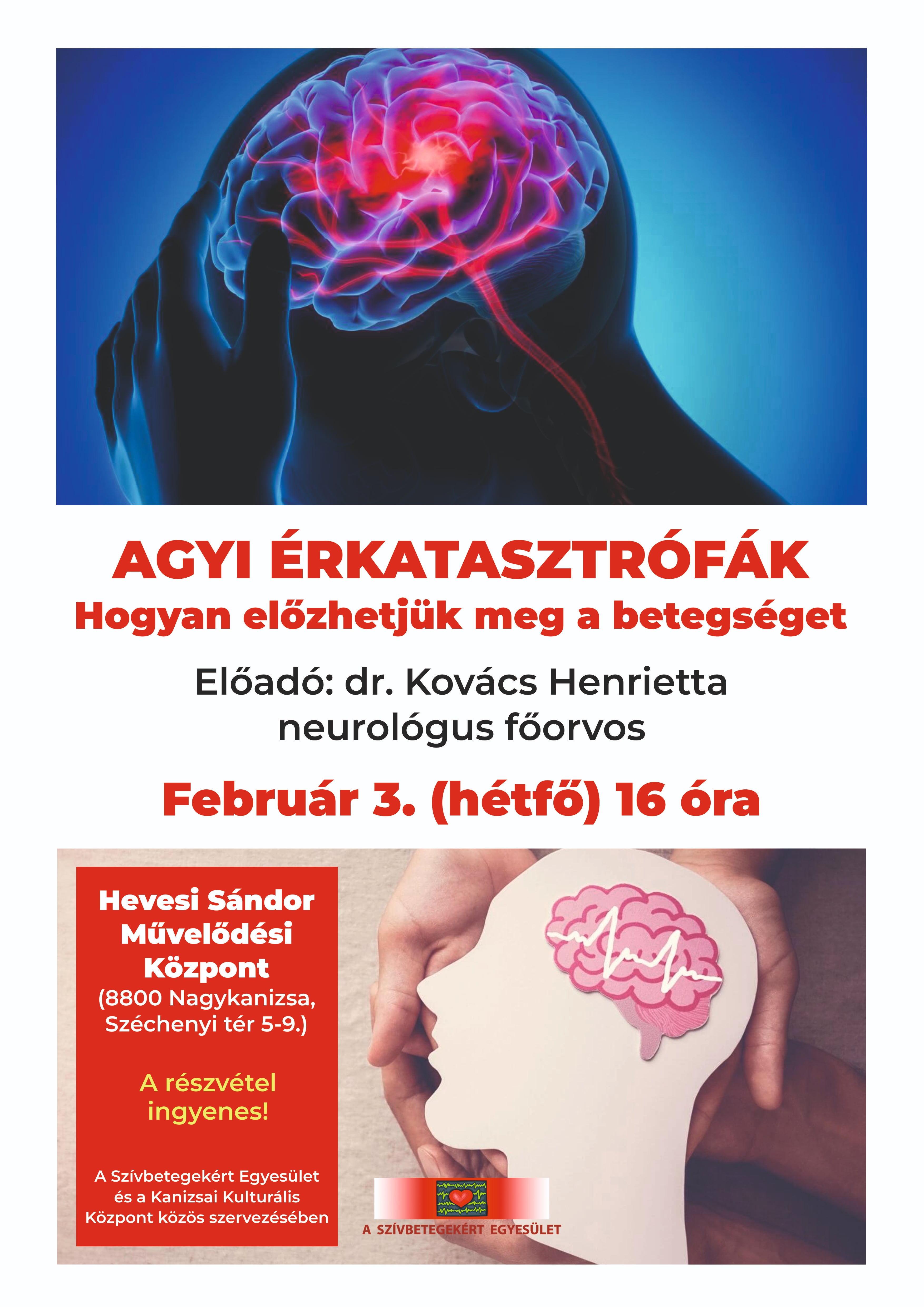 Kiemelő fotó - Agyi érkatasztrófák - hogyan elõzhetjük meg a betegséget? (egészségügyi elõadás)